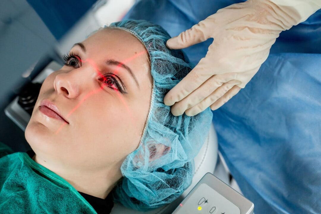 Laser vision correction