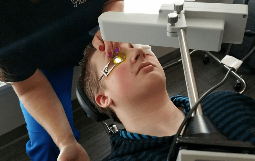 Cross links effectively eliminate keratoconus when starting to grow